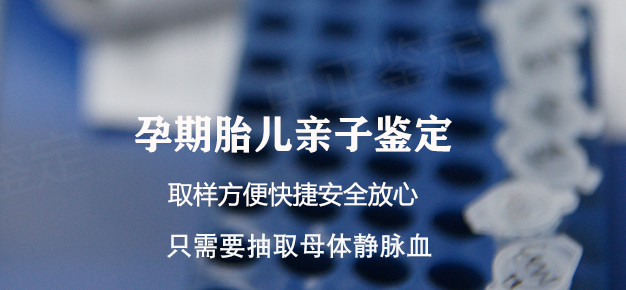 南昌如何做胎儿亲子鉴定,