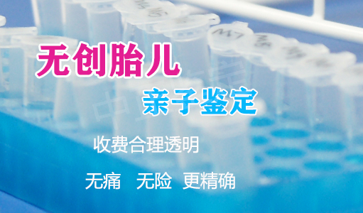怀孕几个月南昌怎么做胎儿亲子鉴定,南昌做孕期亲子鉴定准确率高吗 怀孕几个月南昌怎么做胎儿亲子鉴定,南昌做孕期亲子鉴定准确率高吗
